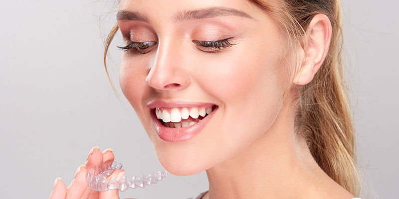 Ortodonzia Invisalign