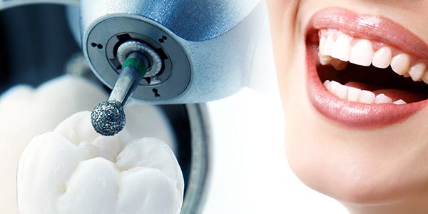 Odontoiatria conservativa